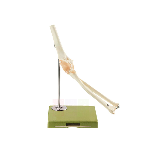 Functional Elbow Joint